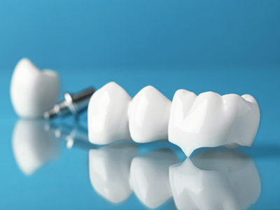 Dental Bridges - Restorative Dentist in Kyle, TX