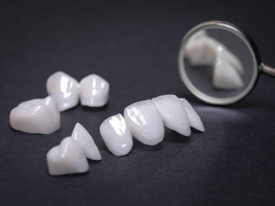 Porcelain Crowns - Cosmetic Dentist in Kyle, TX