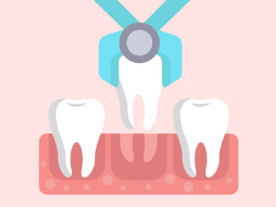 Tooth Extractions - Restorative Dentist in Kyle, TX