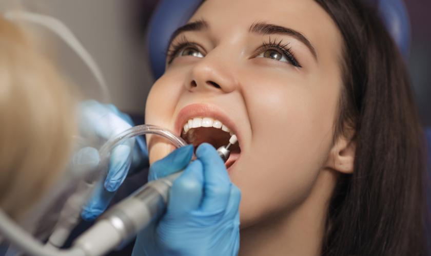 Fluoride Treatment- Unveiling Its Best Use Cases for Stronger, Healthier Teeth